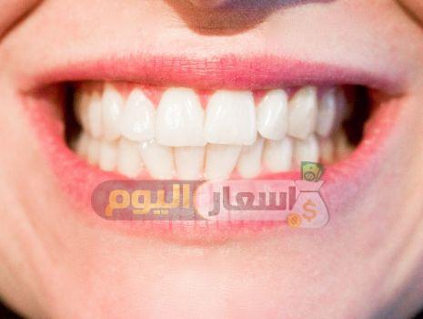 Photo of تكلفة زراعة الأسنان فى مصر 2024