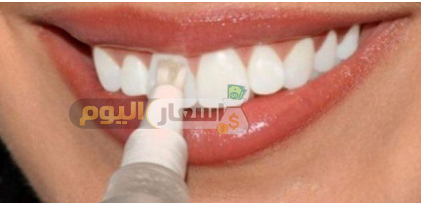 Photo of سعر طربوش الأسنان محدث 2023