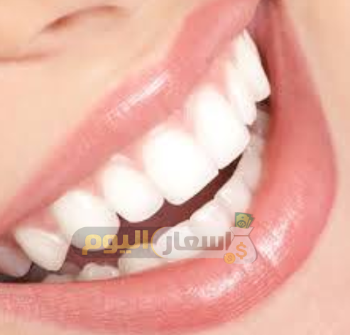 Photo of عروض الأسنان