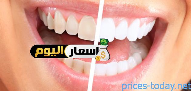 Photo of سعر تلميع الأسنان وتنظيفها من الجير 2024