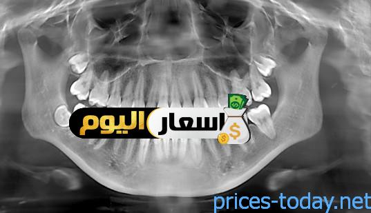 Photo of سعر أشعة الأسنان في مصر 2024