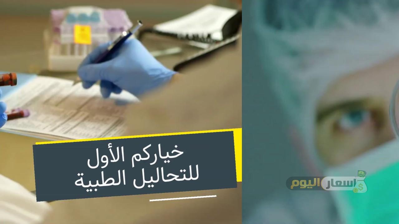 Photo of اسعار التحاليل في معامل سبيد 2024 واهم العروض